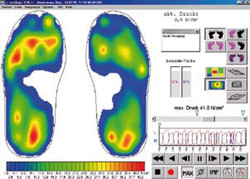 Die Auswertung der Laufbandanalyse erfolgt mit Hilfe modernster Programme auf dem PC. Der geschulte Blick des Sportorthopäden erkennt anhand der Bilder sofort, an welchen Stellen des Fußes der Druck am größten ist. (Foto: TOP Magazin Siegen-Wittgenstein)