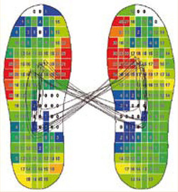 Zur Diagnose gehört auch die individuelle Ausmessung des Fußes. (Foto: TOP Magazin Siegen-Wittgenstein)