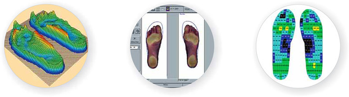 Der diabetische Fuß und seine Diagnose - Digitale Fußdruckmessung. (Foto: www.schein.de) Der diabetische Fuß und seine Diagnose - Digitale Fußdruckmessung. (Foto: www.schein.de)